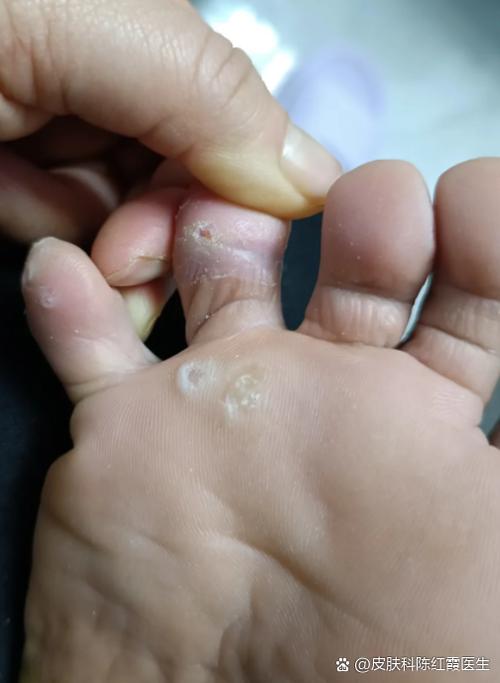 脚上有白色的小圆点图标