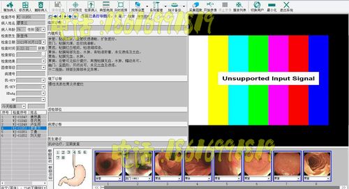 内窥镜软件